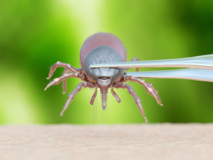 tick removals